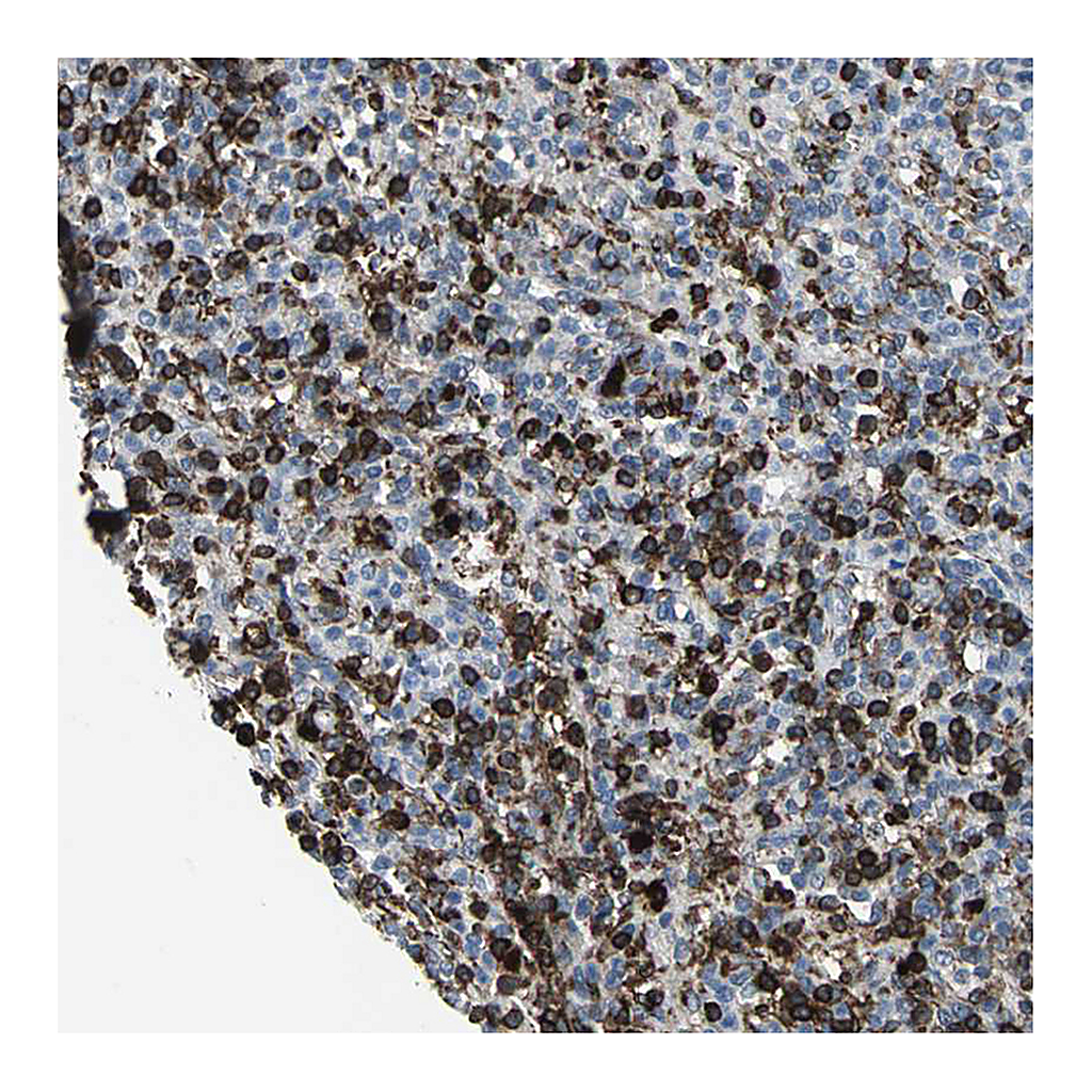 Atlas Antibodies Anti-GLI3 Antibody