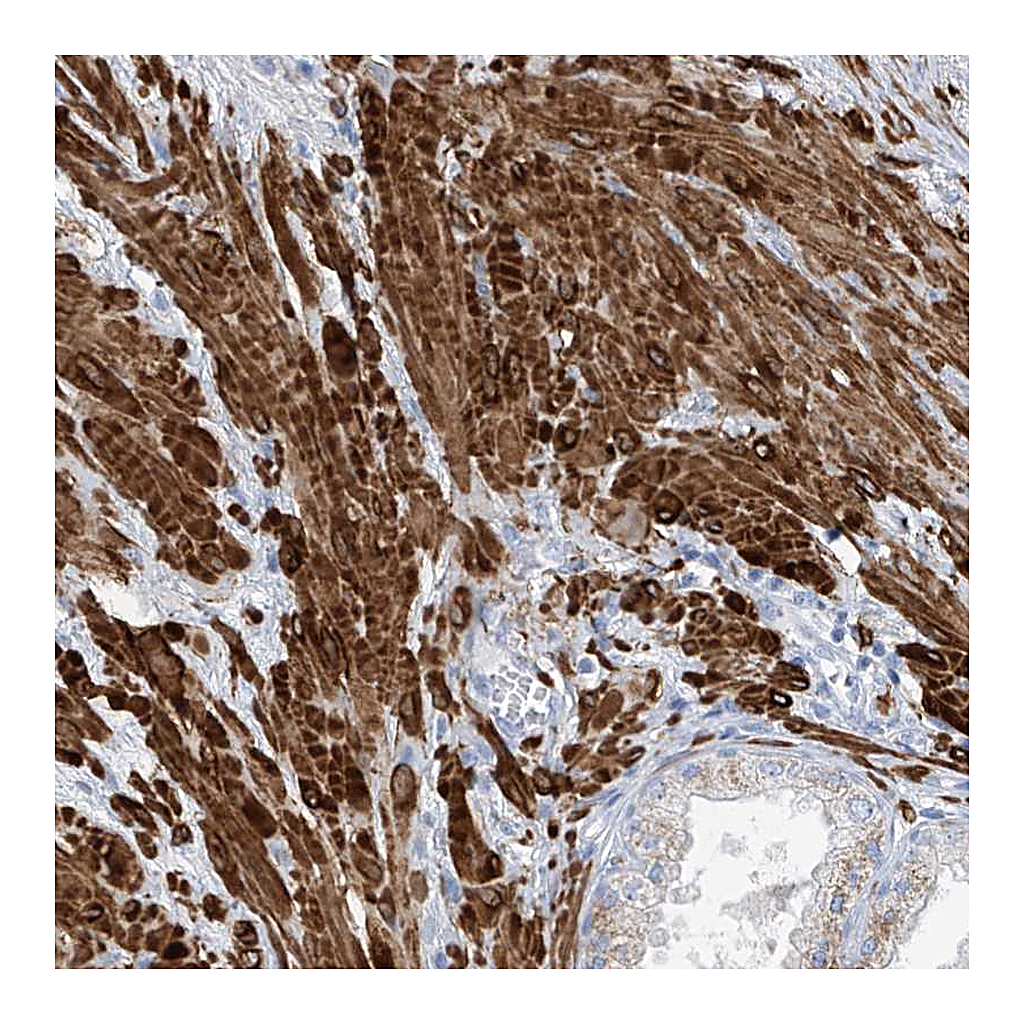 Atlas Antibodies Anti-GLMP Antibody