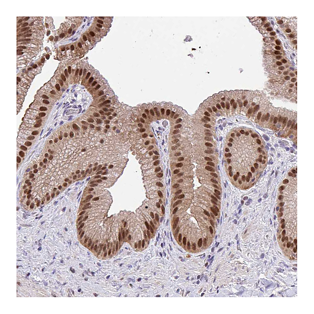 Atlas Antibodies Anti-GLIS3 Antibody