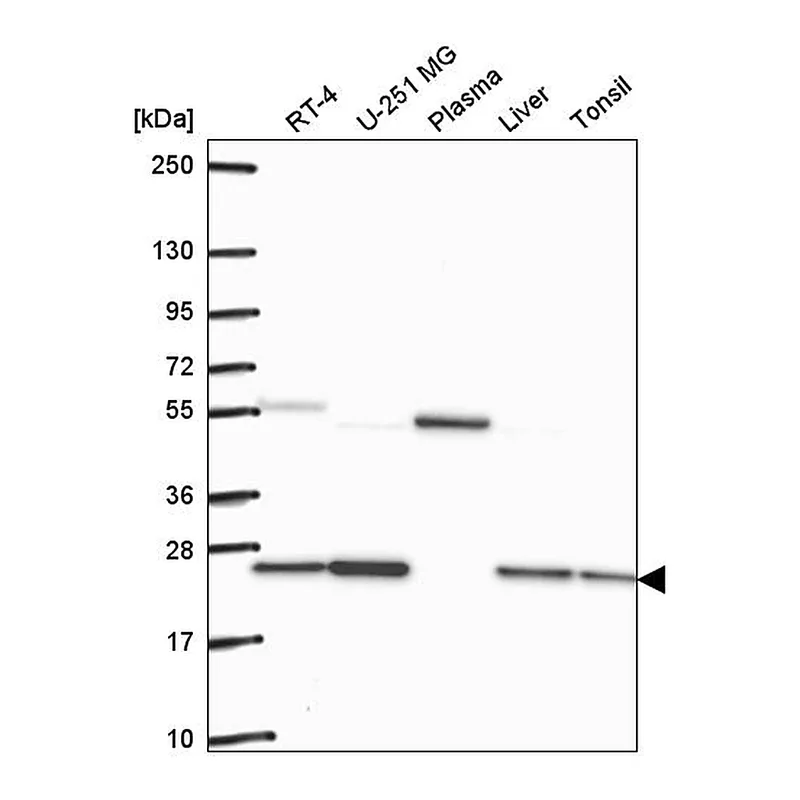 Atlas Antibodies Anti-GLO1 Antibody