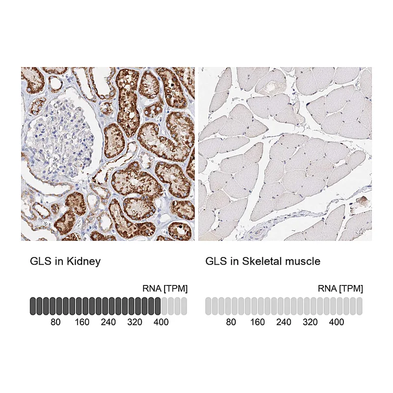 Atlas Antibodies Anti-GLS Antibody
