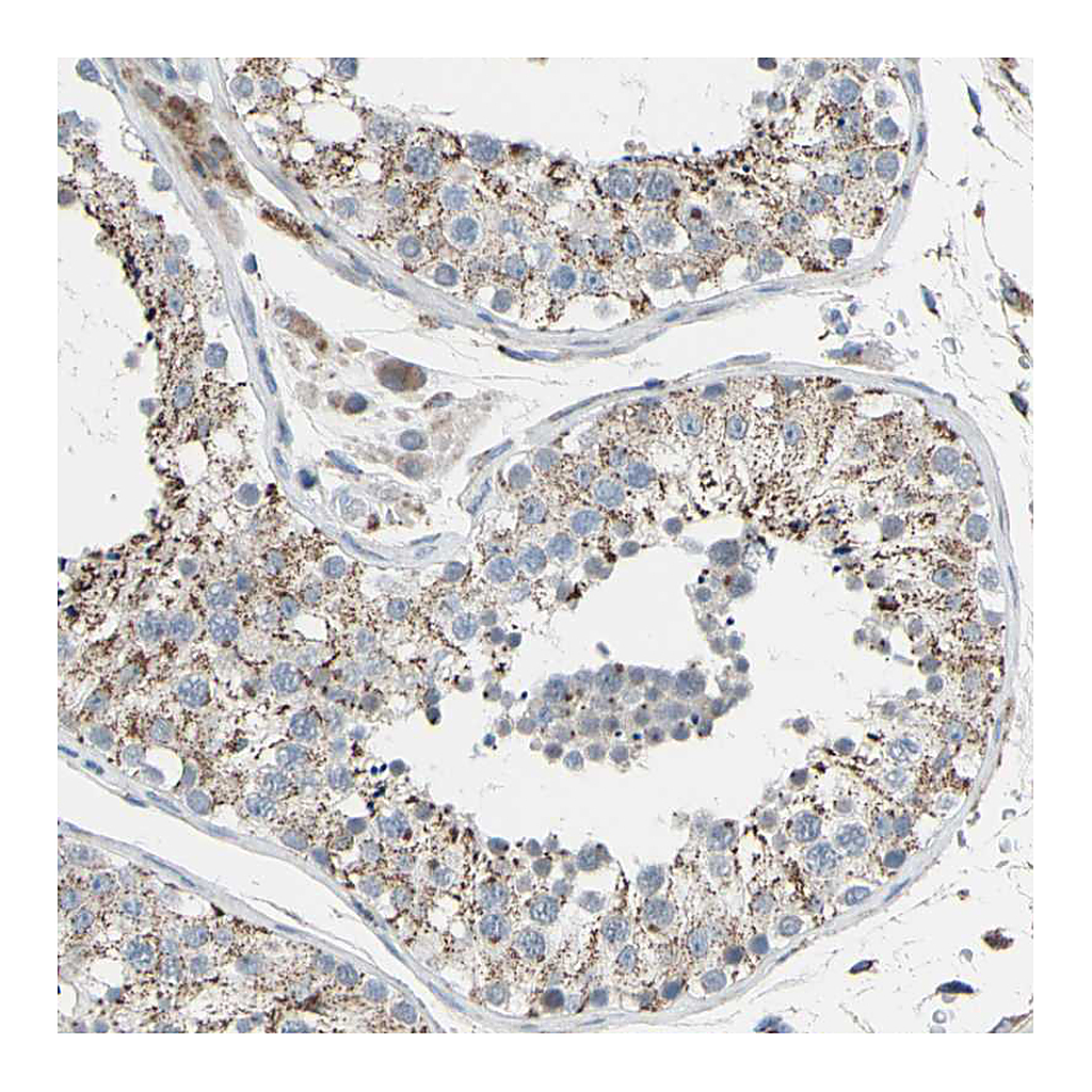 Atlas Antibodies Anti-GLT8D1 Antibody