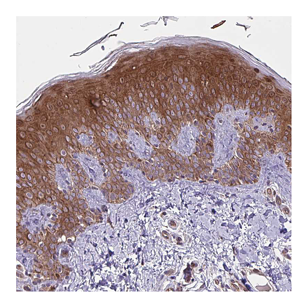 Atlas Antibodies Anti-GLTP Antibody