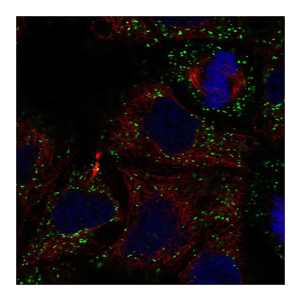 Atlas Antibodies Anti-GLTPD2 Antibody