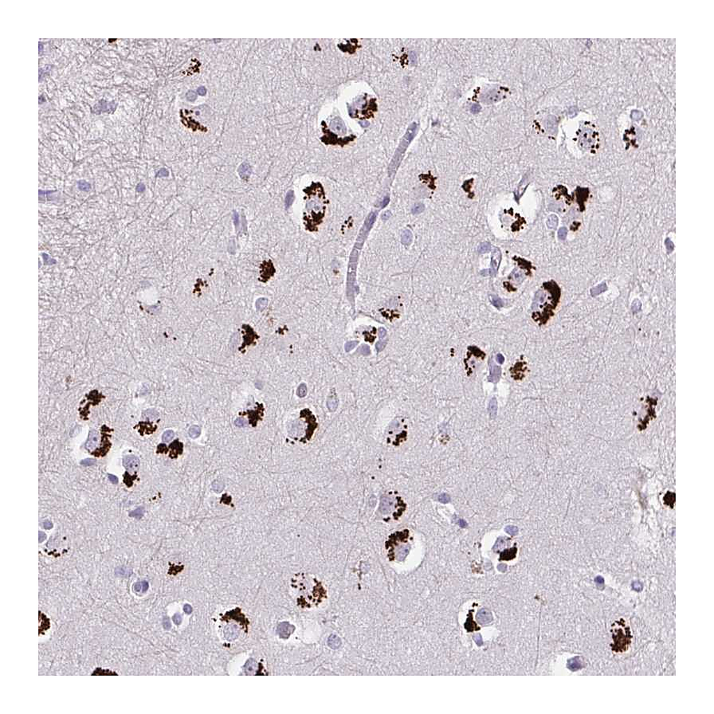 Atlas Antibodies Anti-GLTPD2 Antibody
