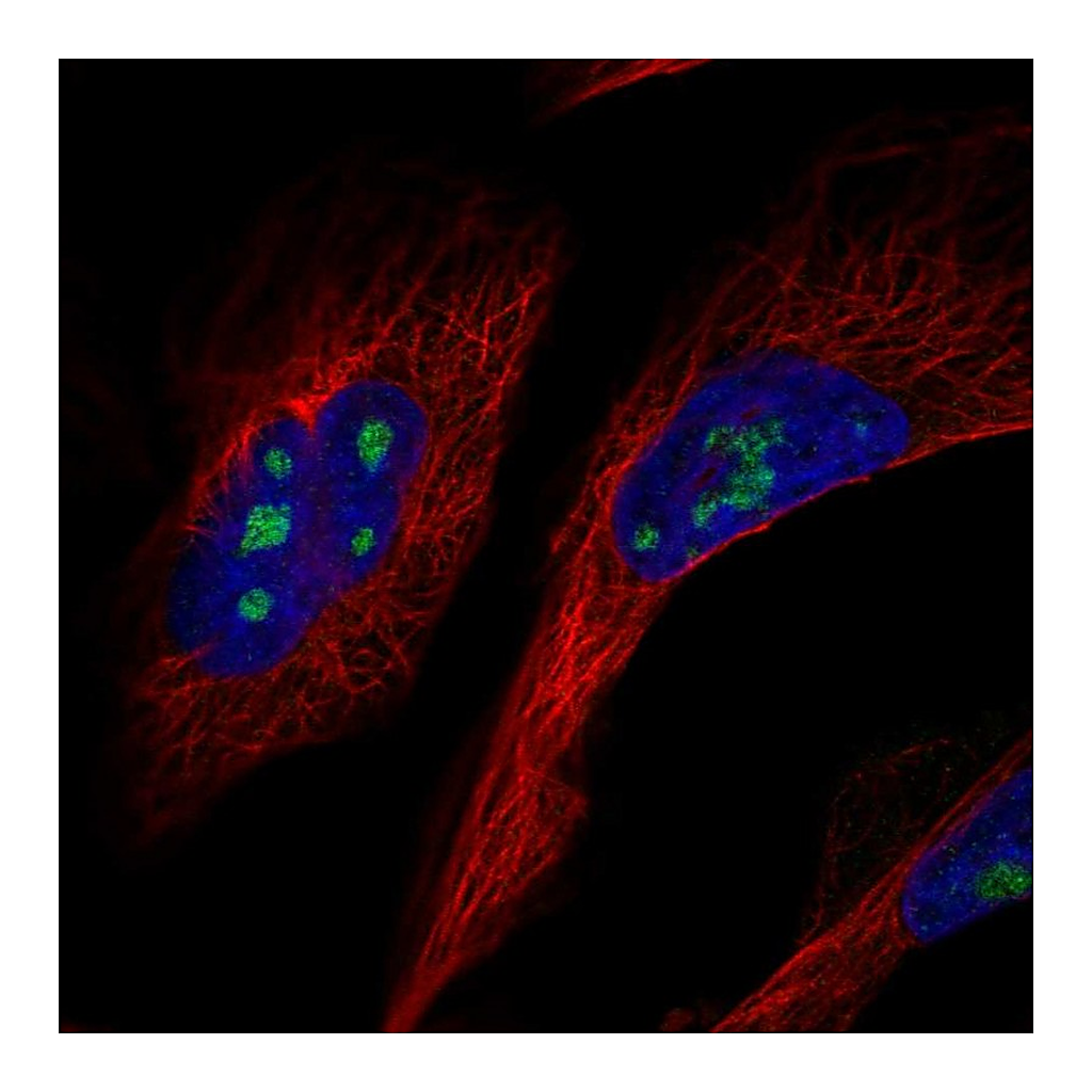 Atlas Antibodies Anti-GLTSCR2 Antibody