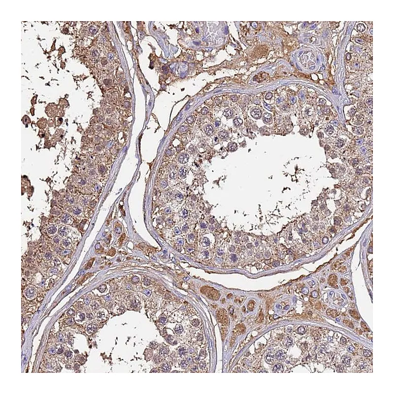 Atlas Antibodies Anti-GLUD1 Antibody