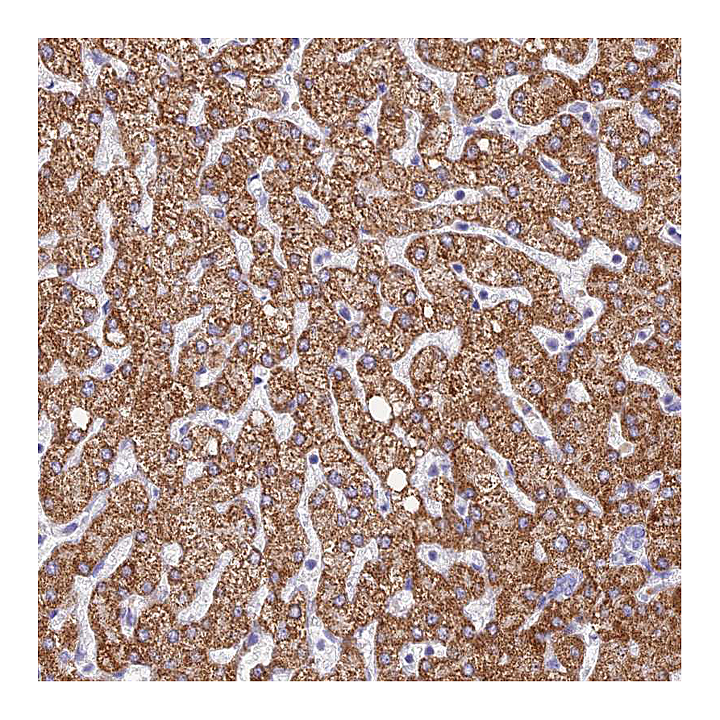 Atlas Antibodies Anti-GLYATL1 Antibody