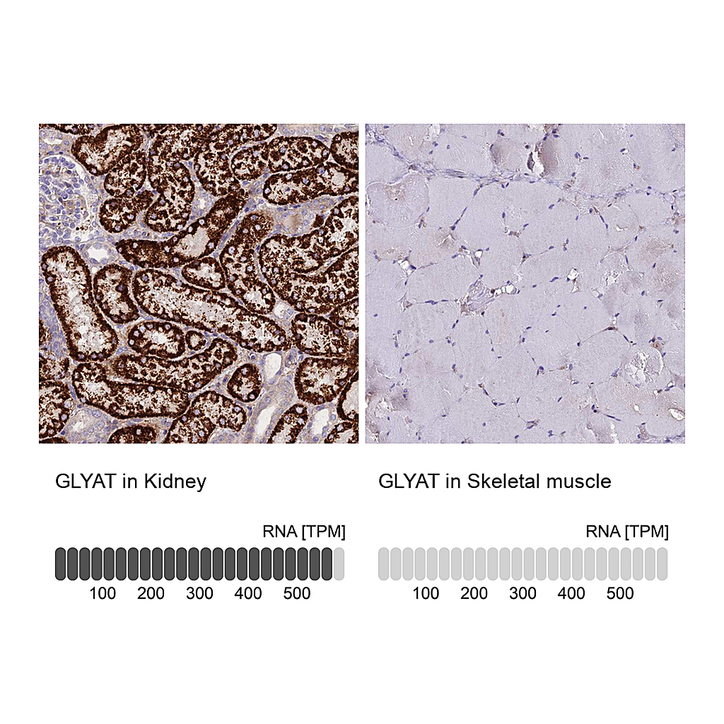 Atlas Antibodies Anti-GLYAT Antibody