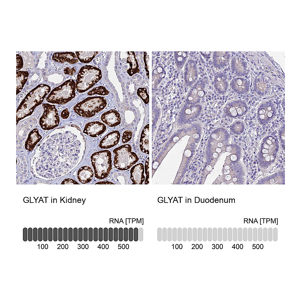 Atlas Antibodies Anti-GLYAT Antibody