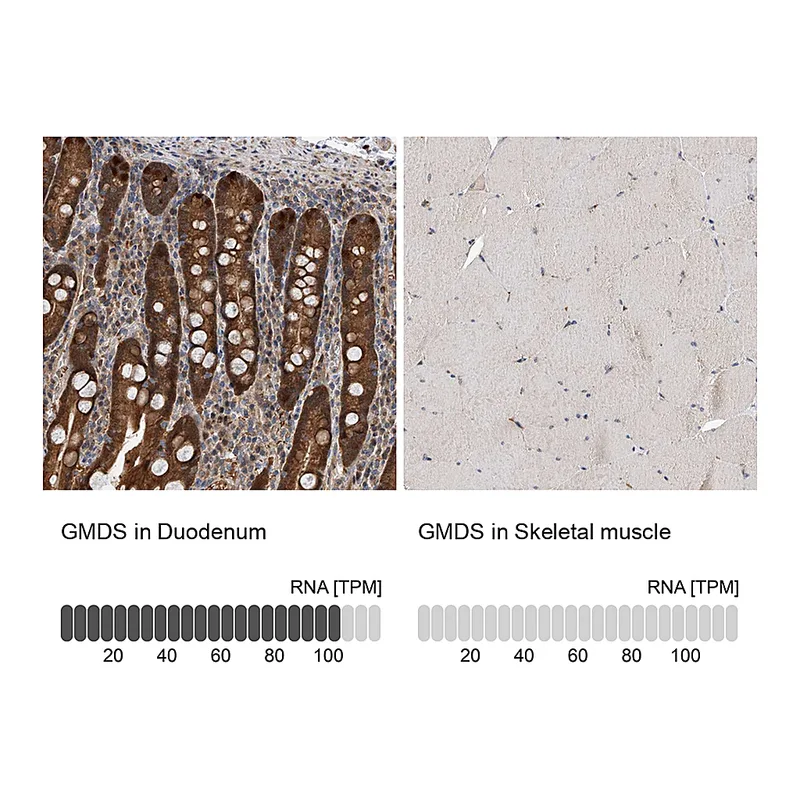 Atlas Antibodies Anti-GMDS Antibody