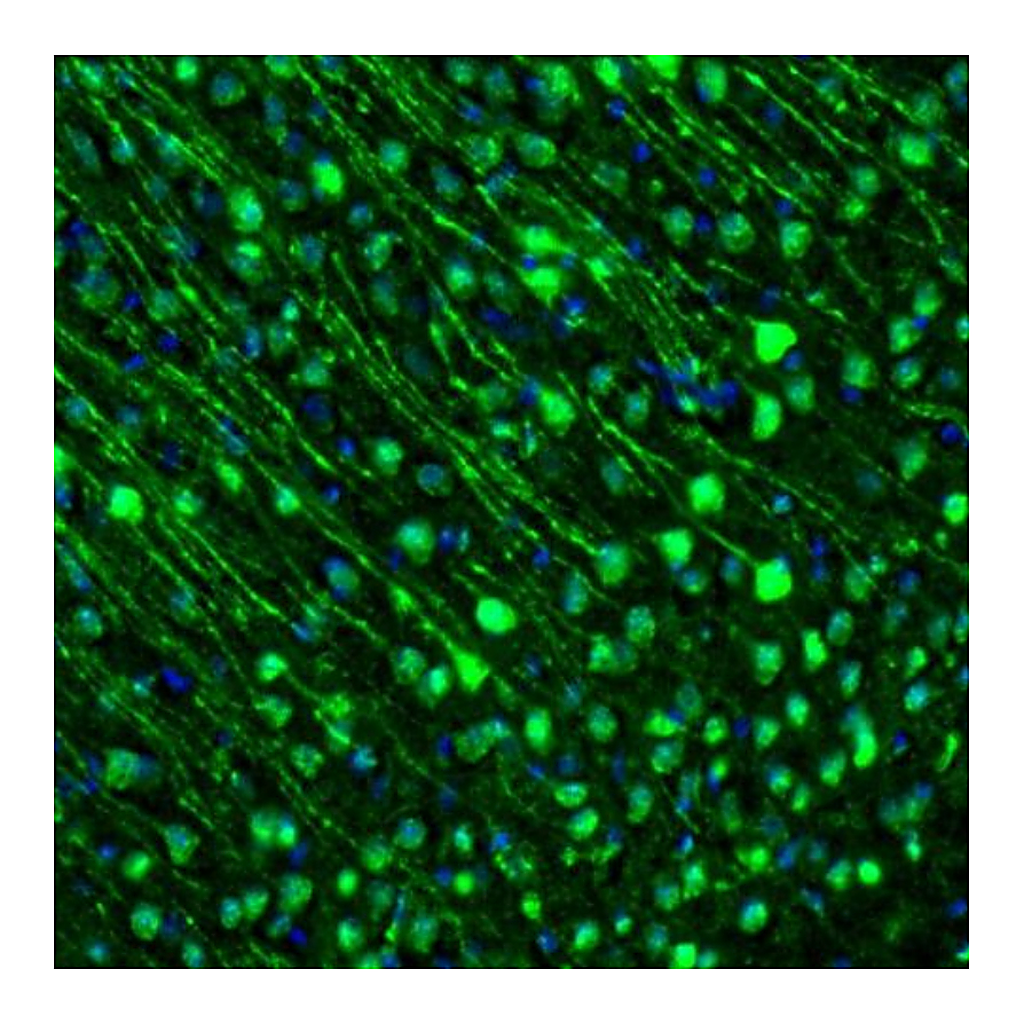 Atlas Antibodies Anti-GMFB Antibody