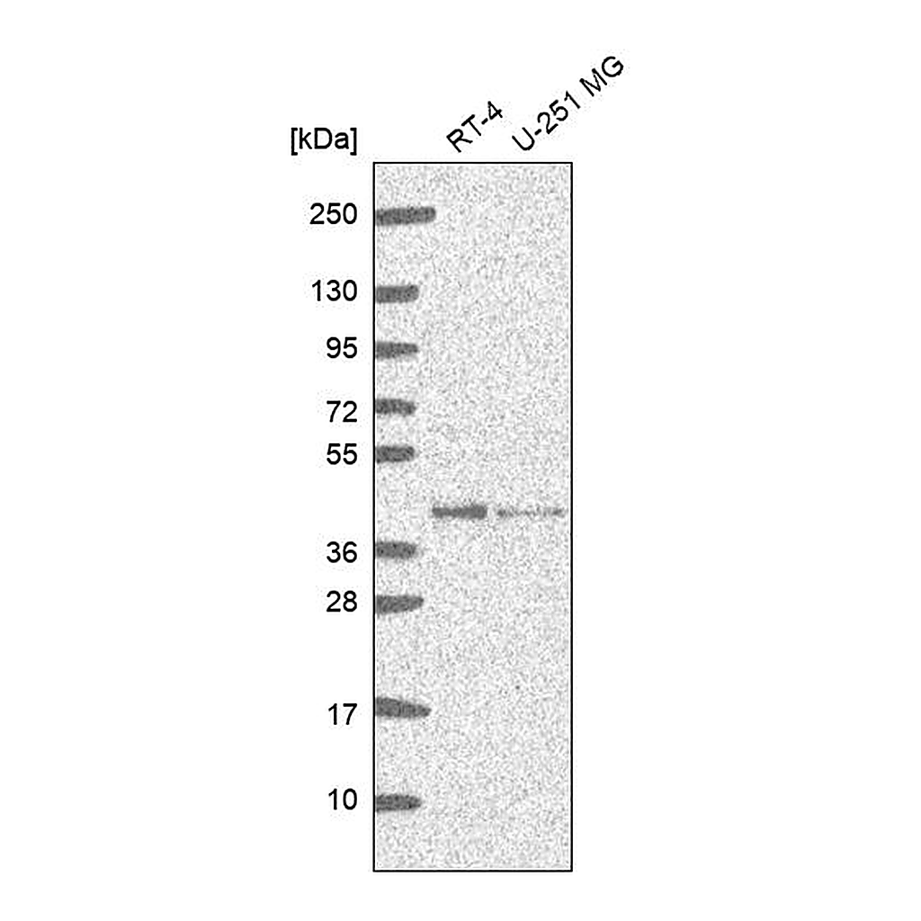 Atlas Antibodies Anti-GMPR2 Antibody
