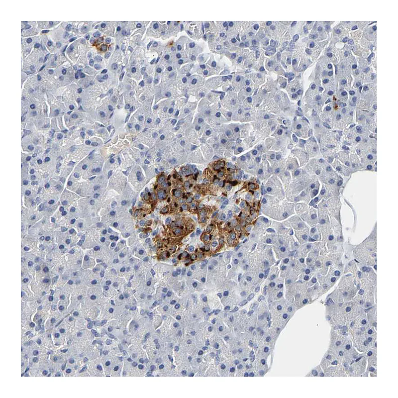 Atlas Antibodies Anti-GNAS Antibody
