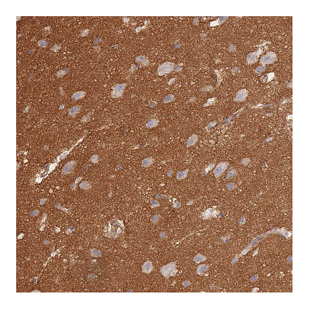 Atlas Antibodies Anti-GNB4 Antibody
