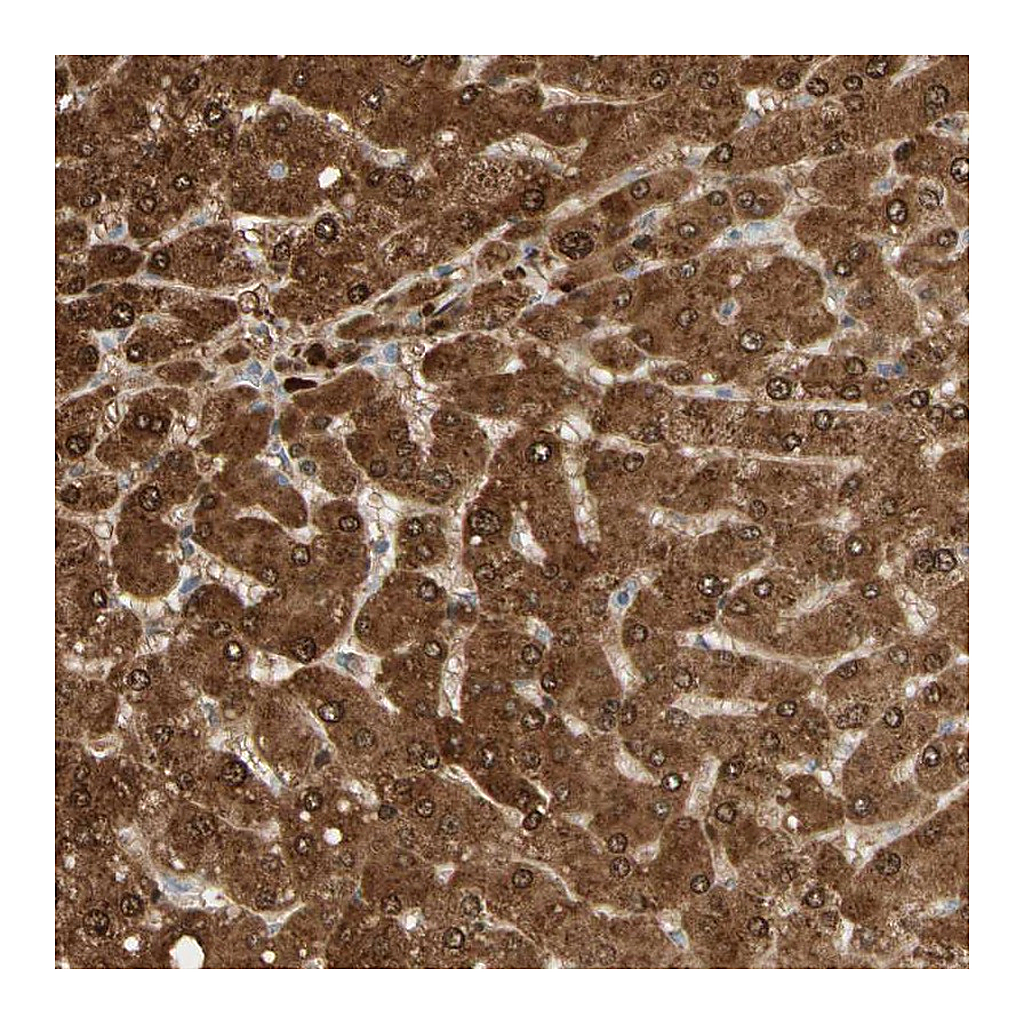 Atlas Antibodies Anti-GNE Antibody