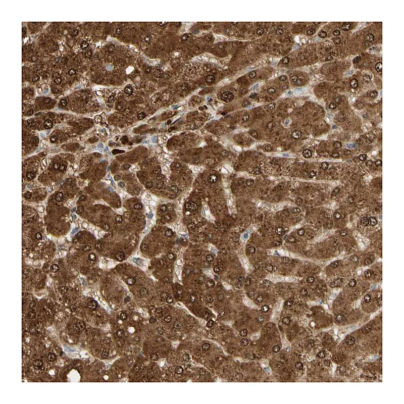 Atlas Antibodies Anti-GNE Antibody