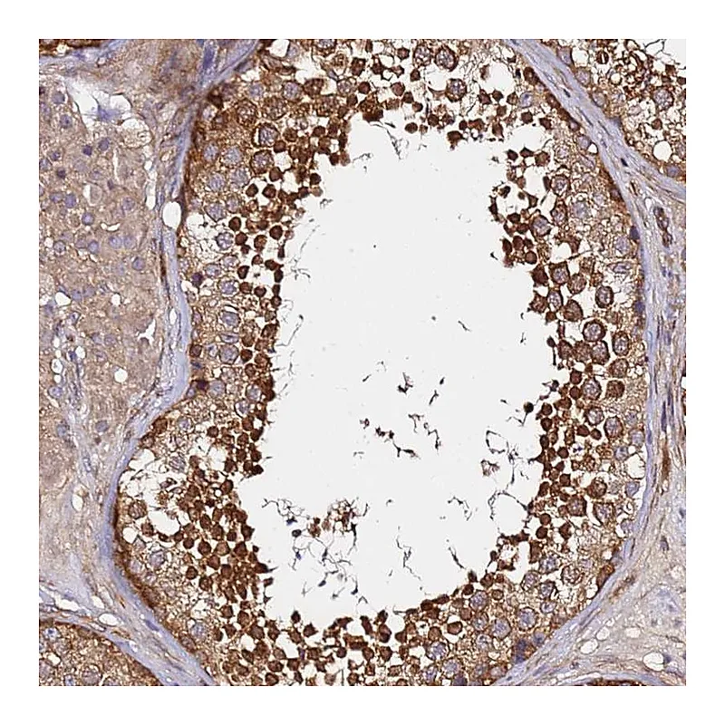 Atlas Antibodies Anti-GNL1 Antibody