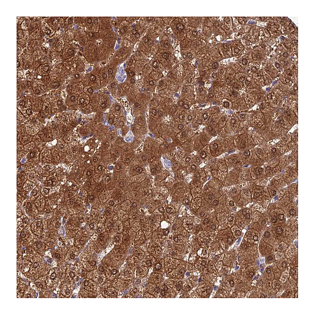 Atlas Antibodies Anti-GNPNAT1 Antibody