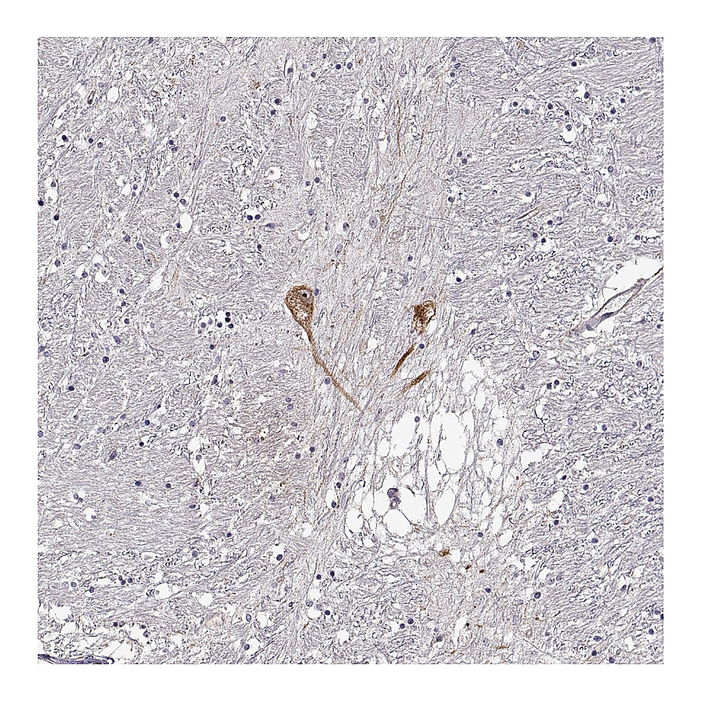 Atlas Antibodies Anti-GNRH1 Antibody