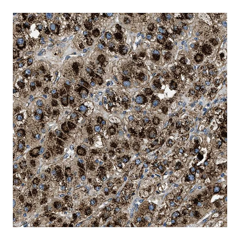 Atlas Antibodies Anti-GNS Antibody