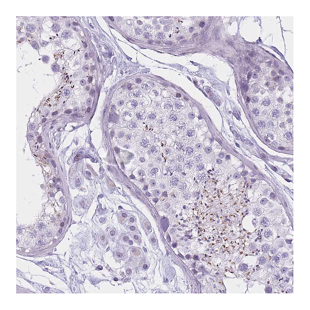 Atlas Antibodies Anti-GOLGA6B Antibody