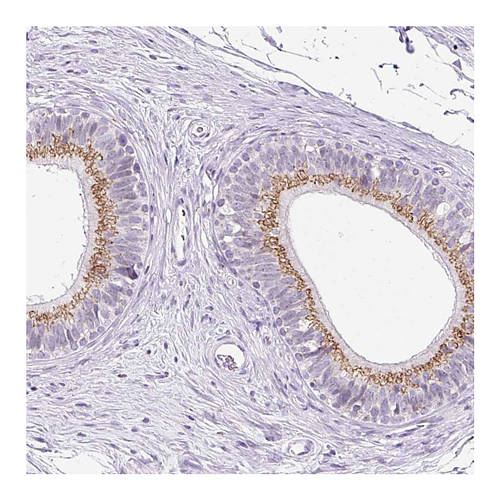 Atlas Antibodies Anti-GOLGA8A Antibody