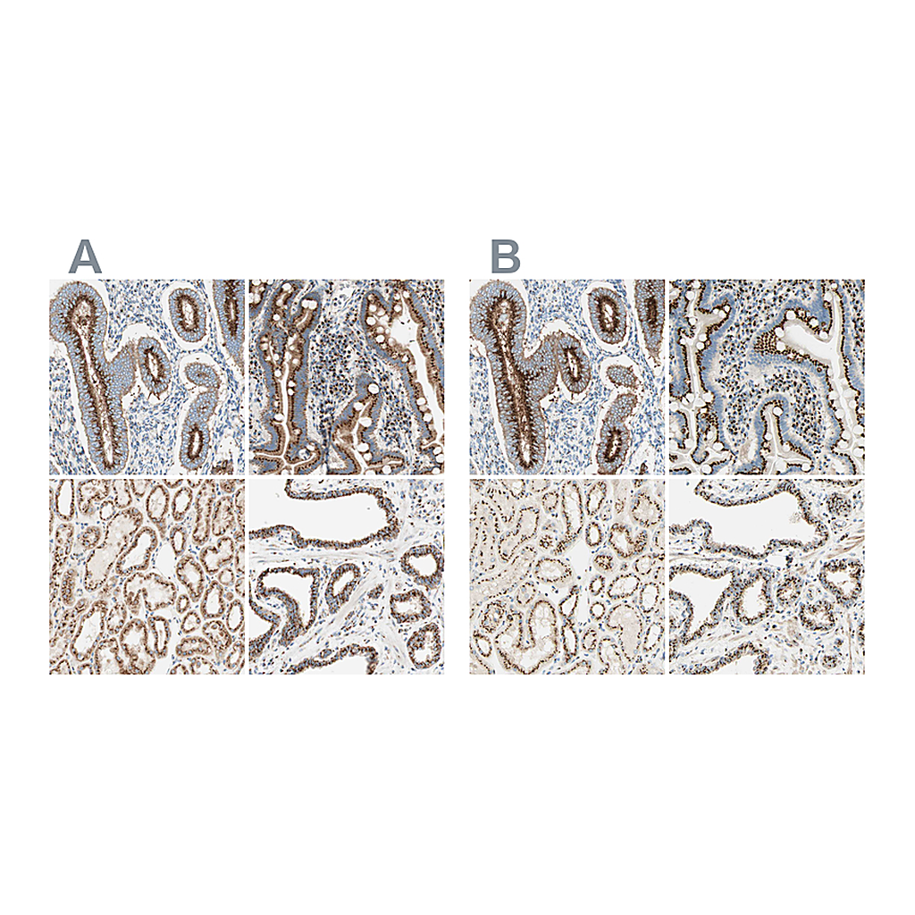 Atlas Antibodies Anti-GOLGB1 Antibody