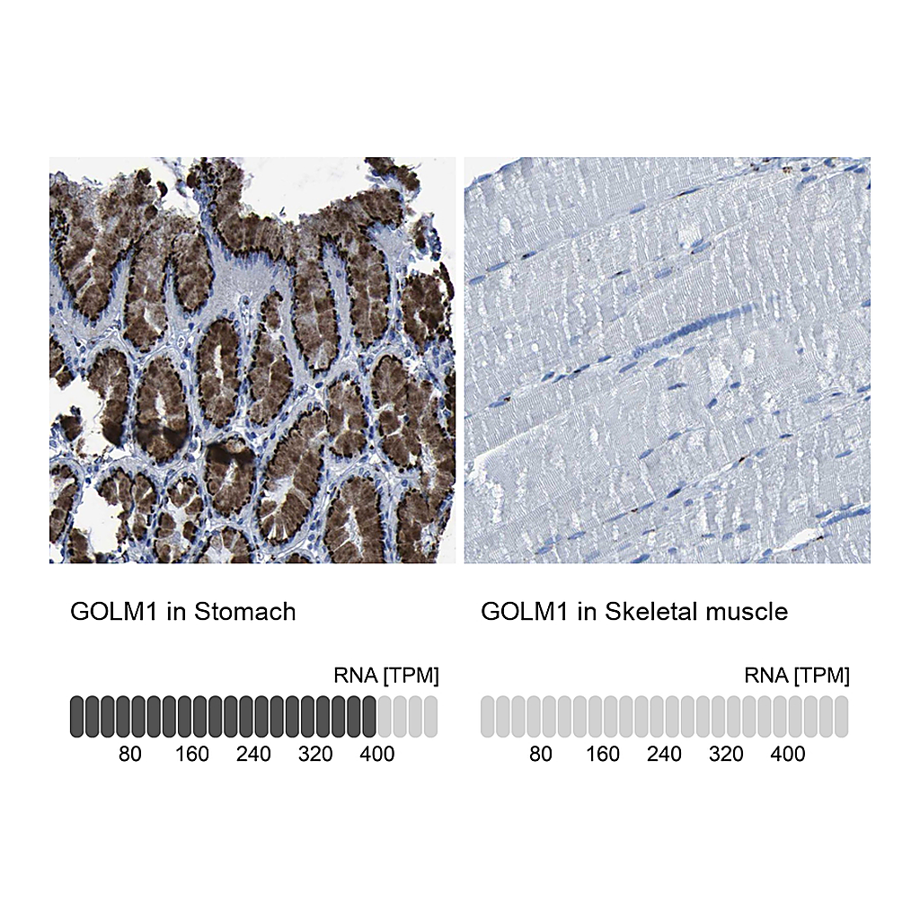 Atlas Antibodies Anti-GOLM1 Antibody