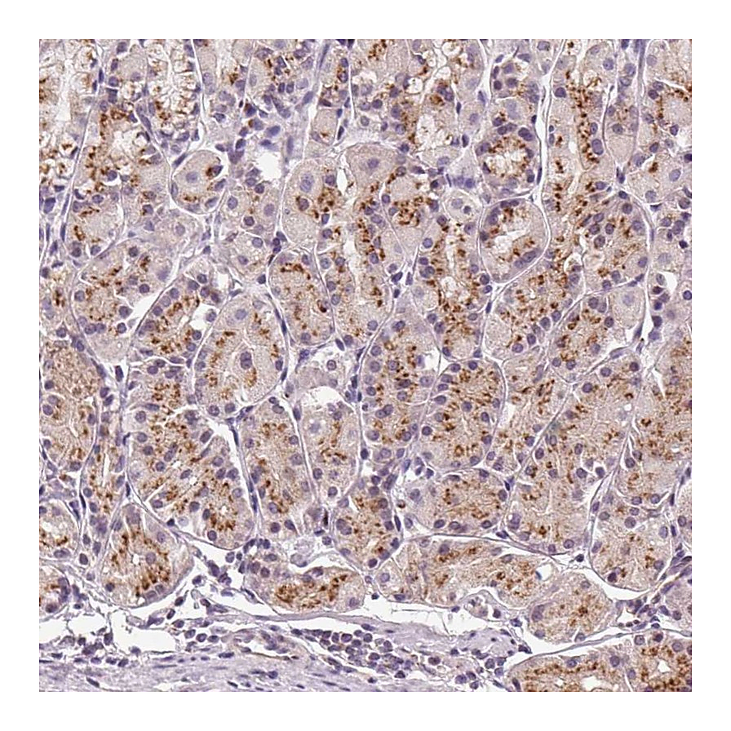 Atlas Antibodies Anti-GOLPH3 Antibody