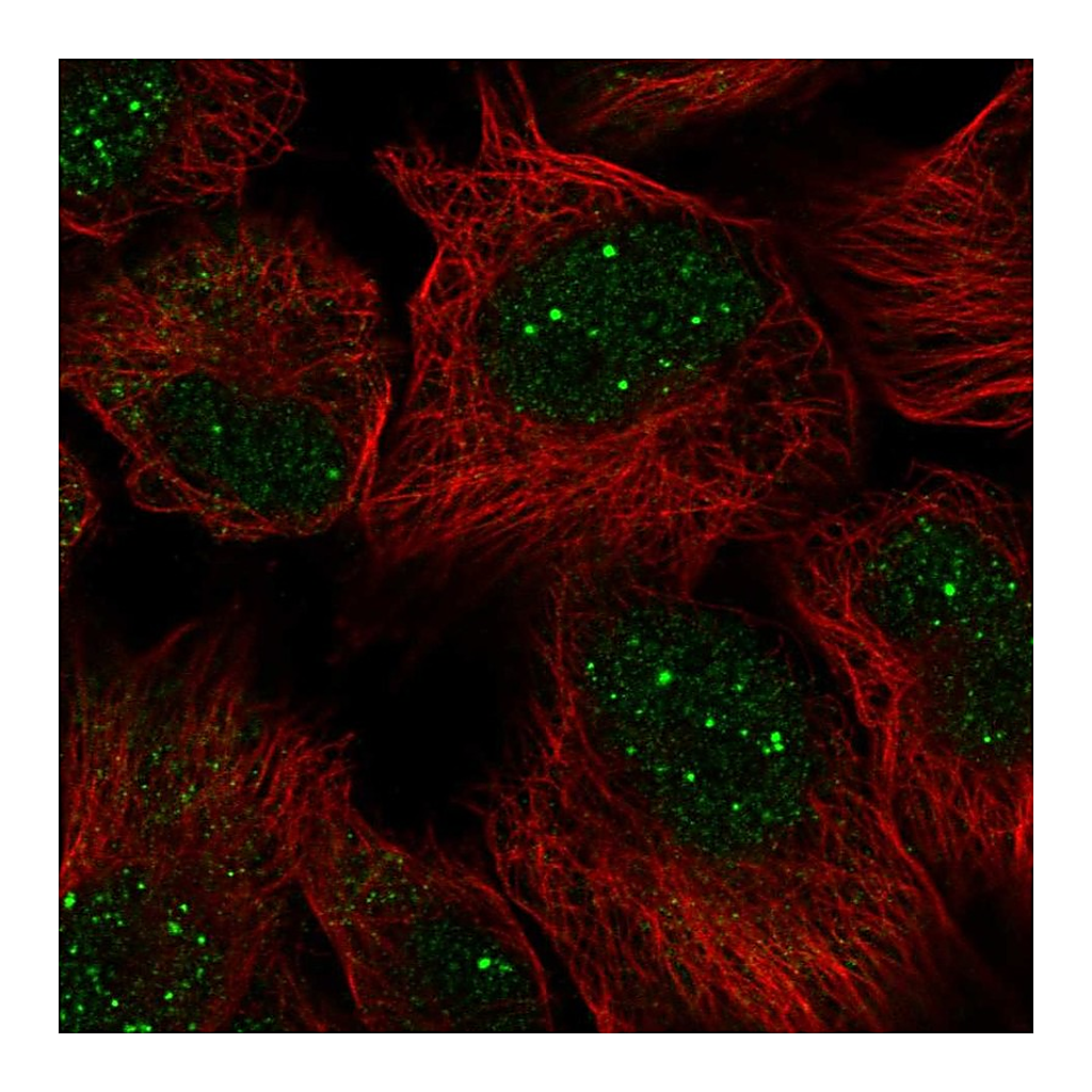Atlas Antibodies Anti-GON4L Antibody