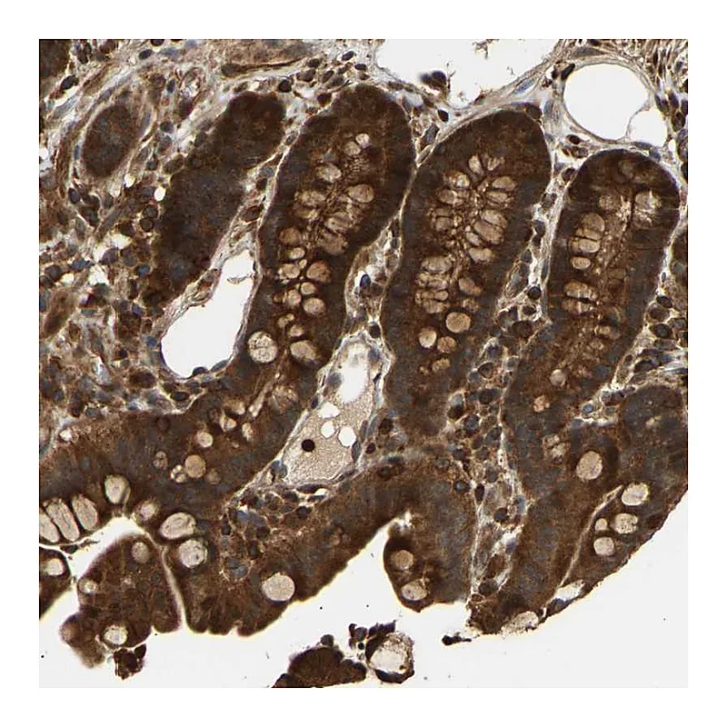 Atlas Antibodies Anti-GOPC Antibody