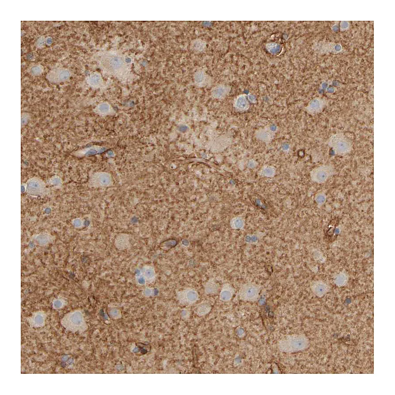 Atlas Antibodies Anti-GOPC Antibody