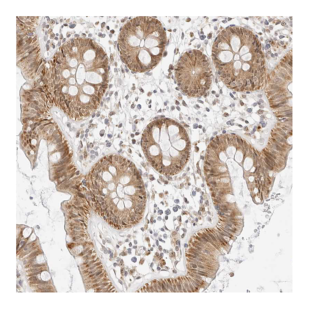 Atlas Antibodies Anti-GORAB Antibody