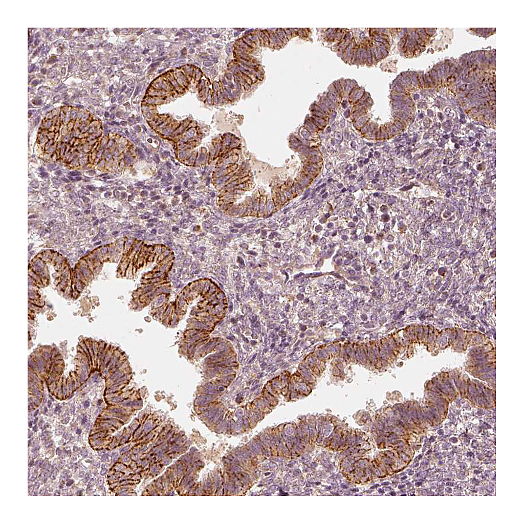 Atlas Antibodies Anti-GORASP2 Antibody