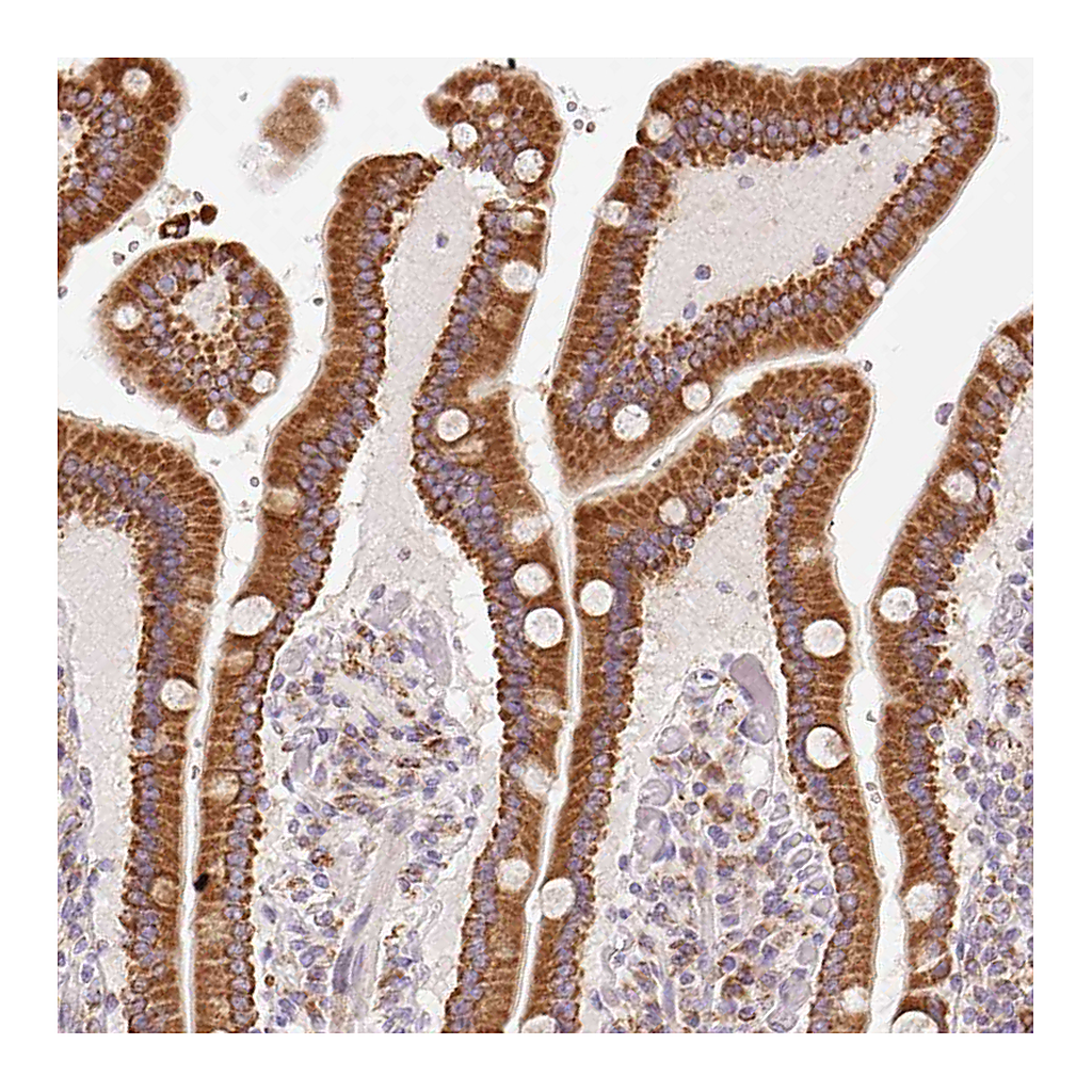 Atlas Antibodies Anti-GOSR2 Antibody