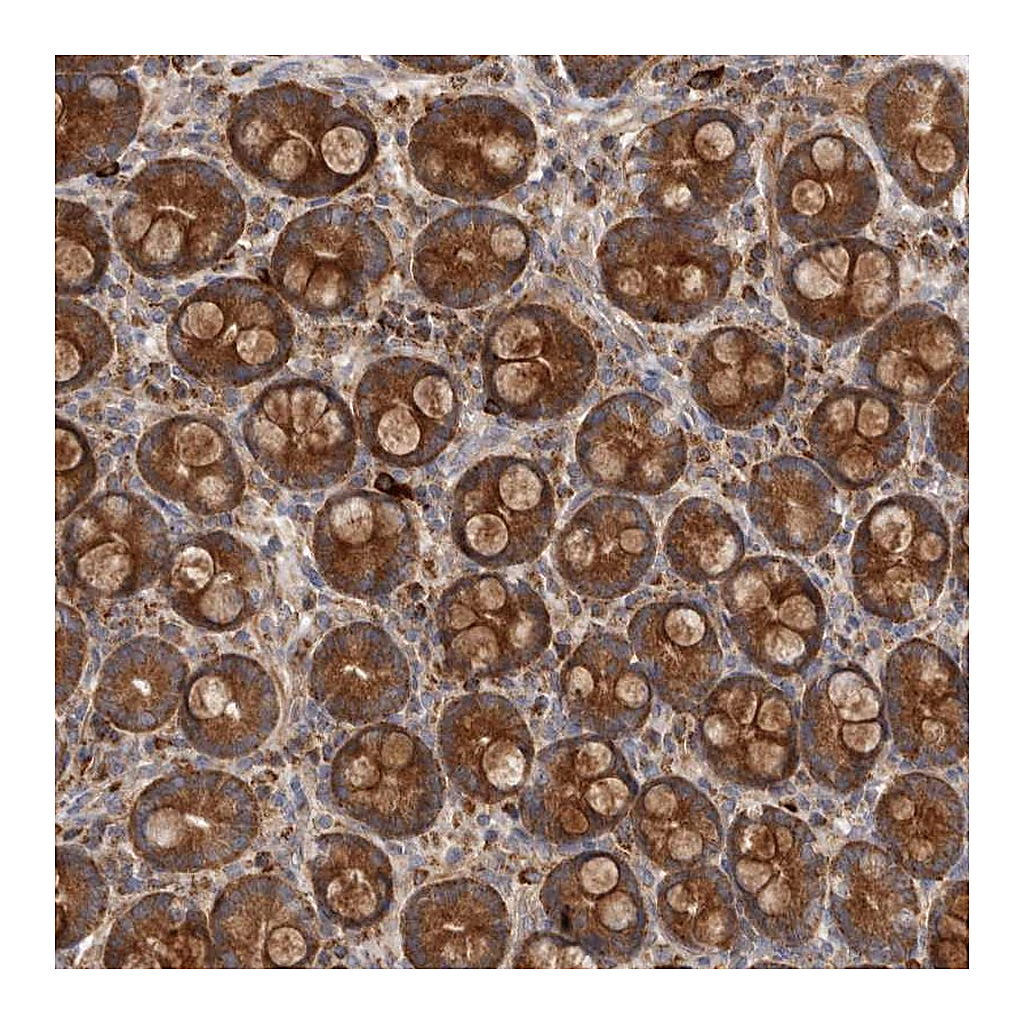 Atlas Antibodies Anti-GOT1L1 Antibody