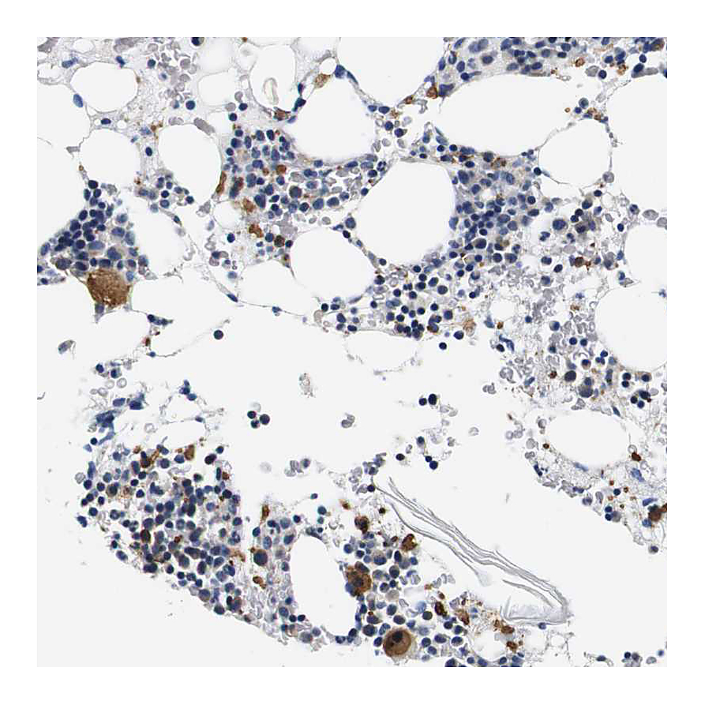 Atlas Antibodies Anti-GP1BA Antibody