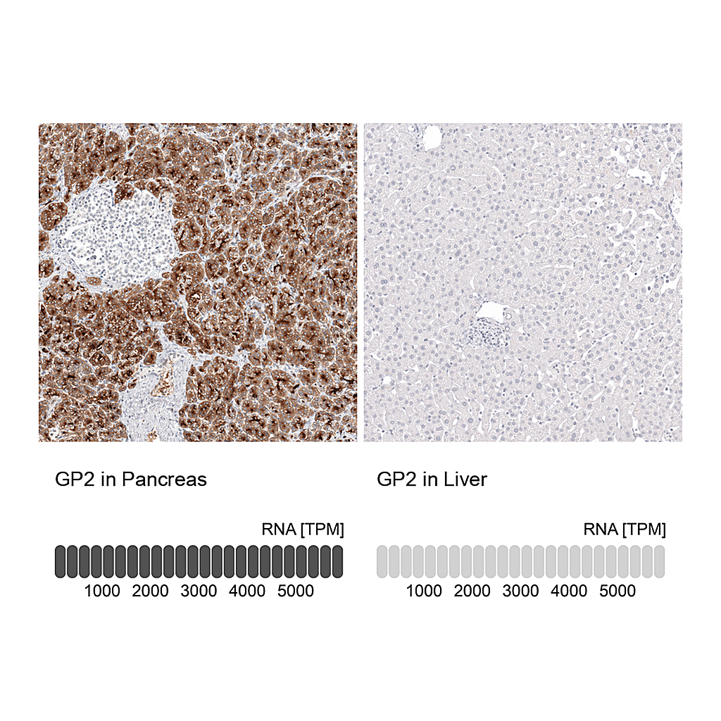 Atlas Antibodies Anti-GP2 Antibody