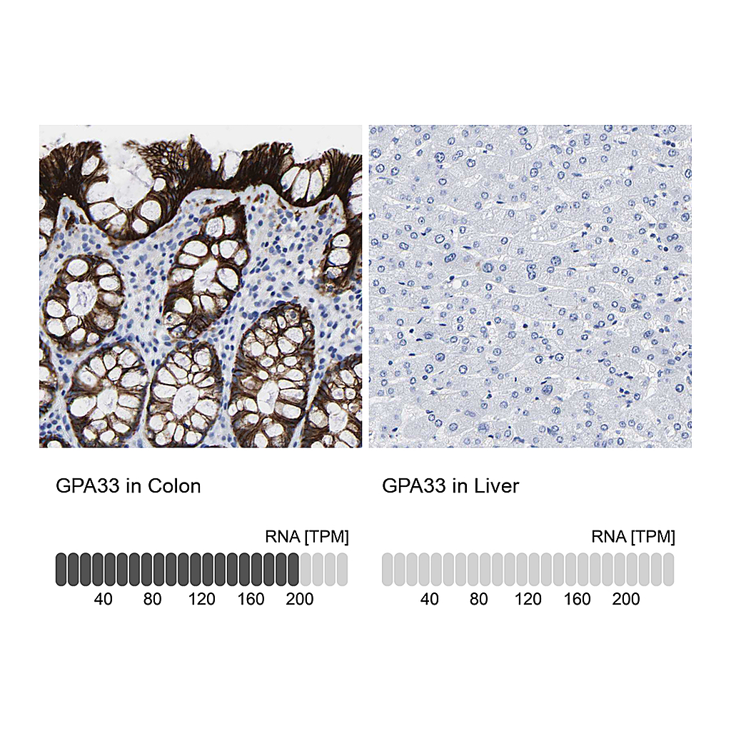Atlas Antibodies Anti-GPA33 Antibody