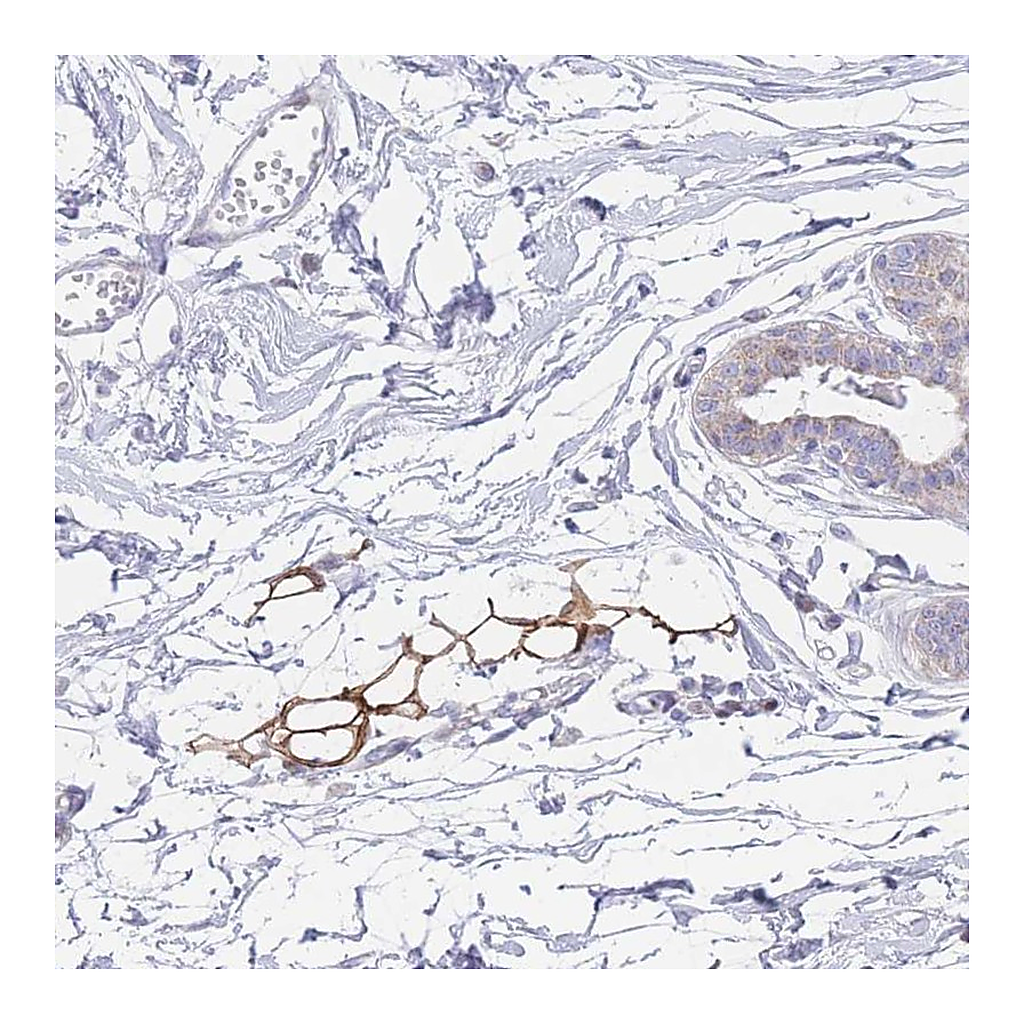 Atlas Antibodies Anti-GPAM Antibody