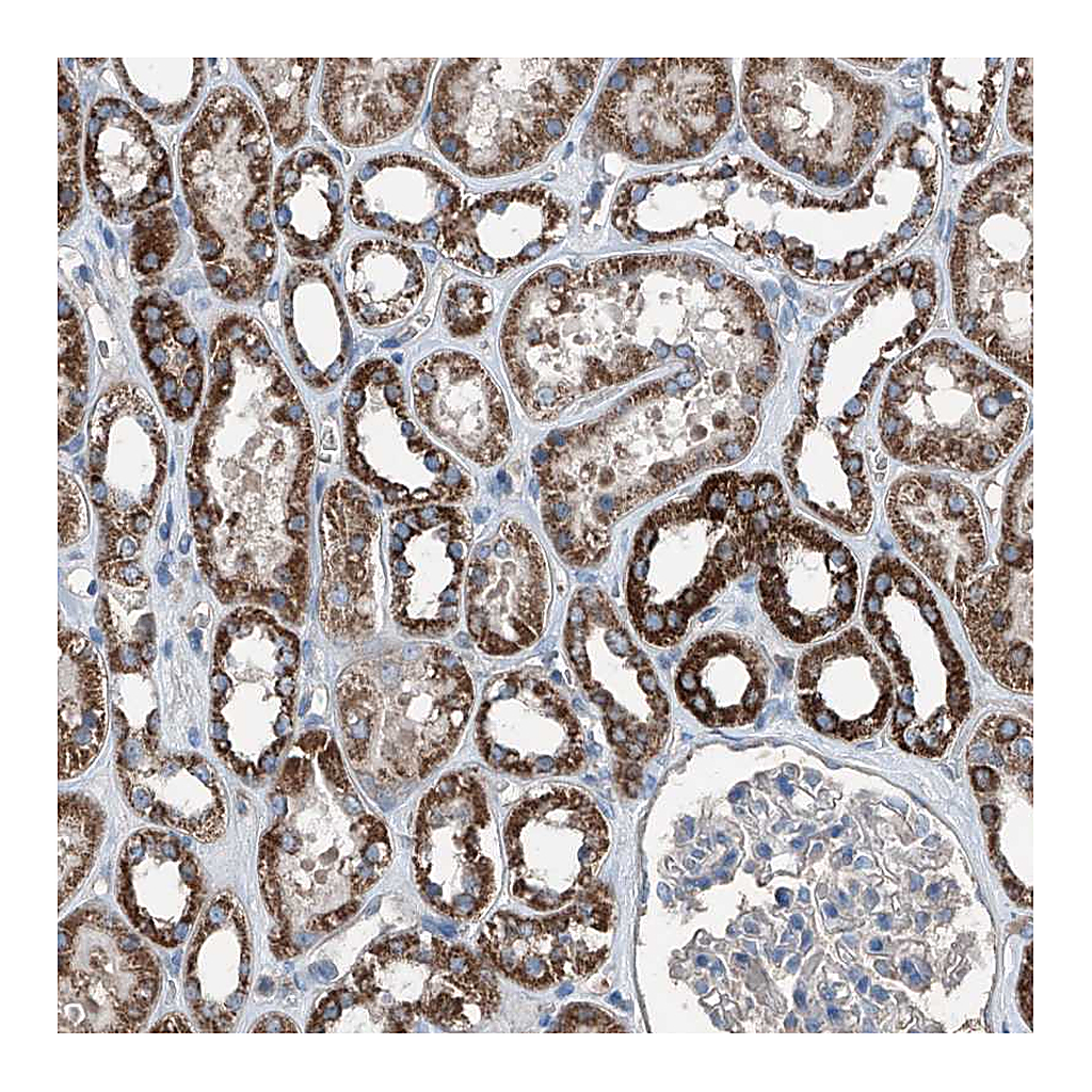 Atlas Antibodies Anti-GPAT3 Antibody