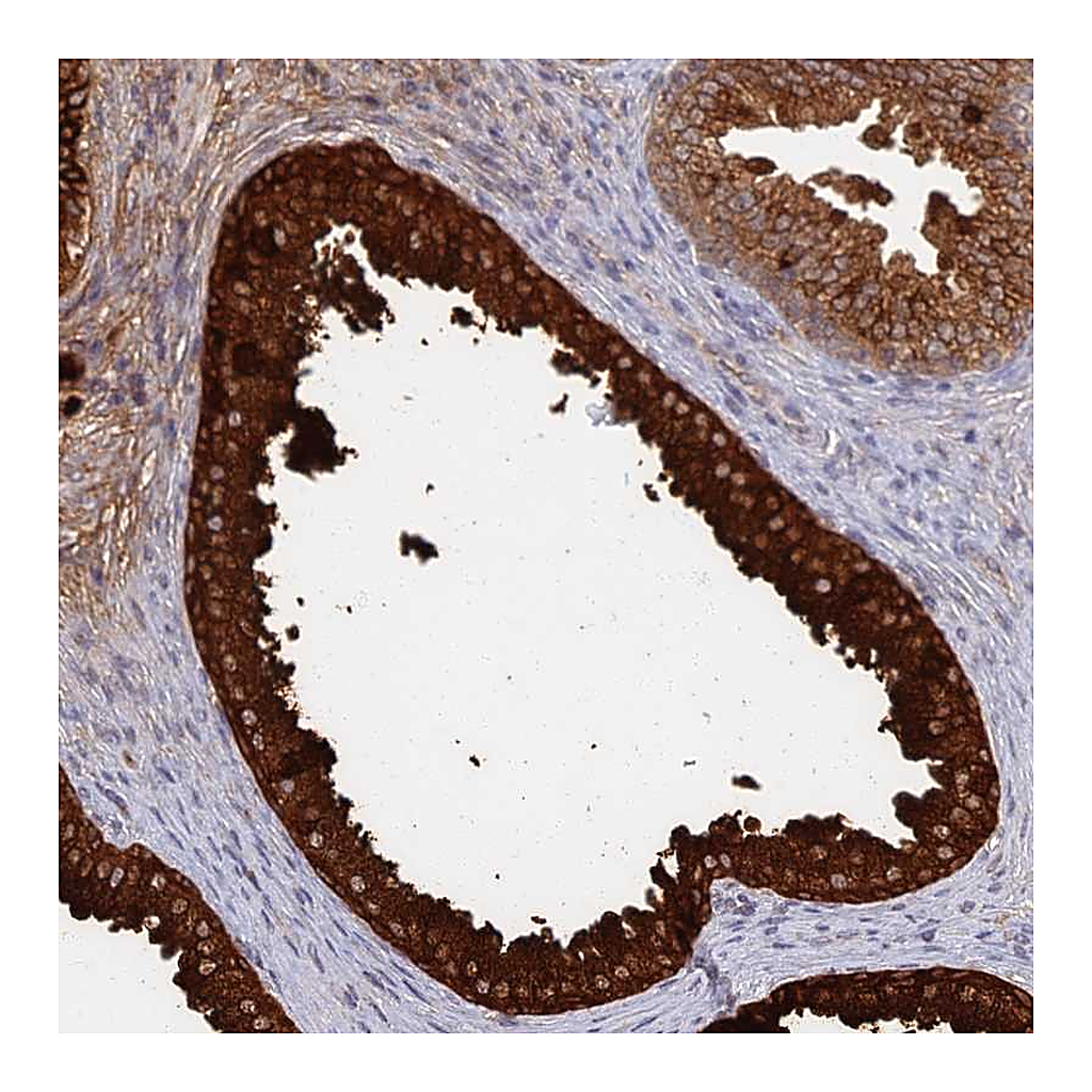 Atlas Antibodies Anti-GPATCH1 Antibody