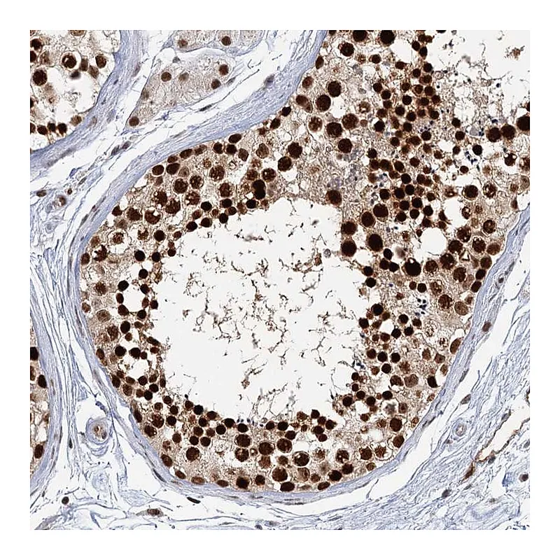 Atlas Antibodies Anti-GPATCH11 Antibody