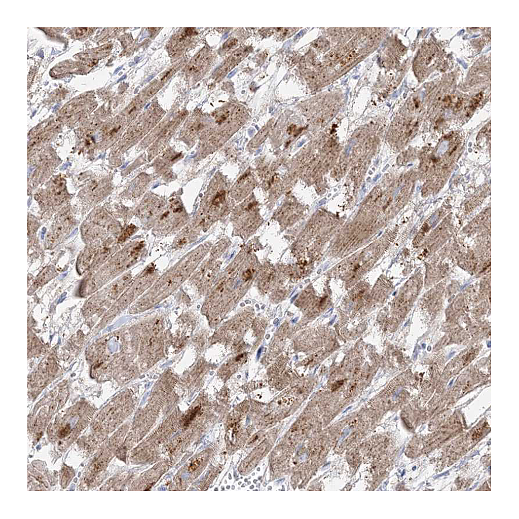 Atlas Antibodies Anti-GPAT2 Antibody