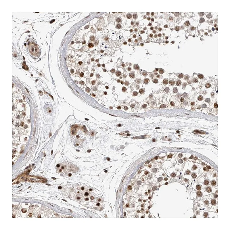 Atlas Antibodies Anti-GPATCH2 Antibody