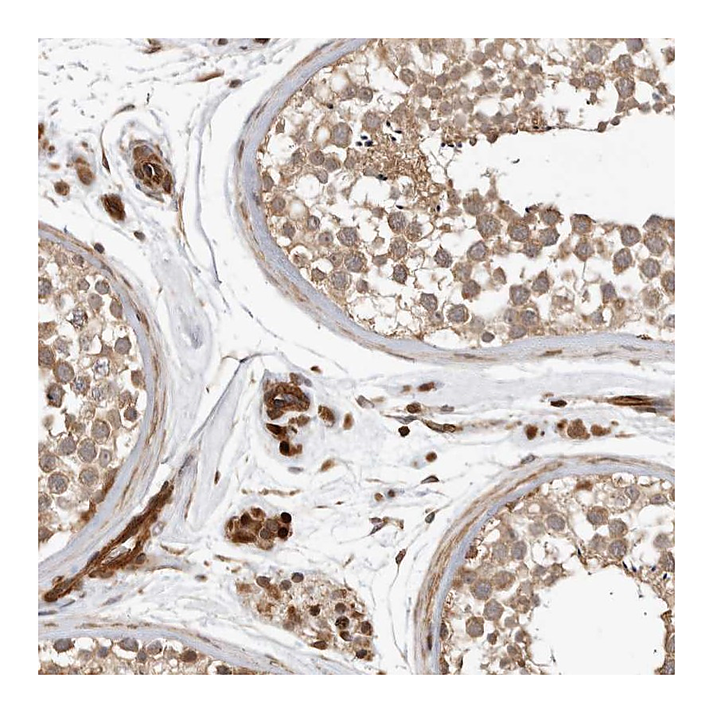 Atlas Antibodies Anti-GPATCH2 Antibody