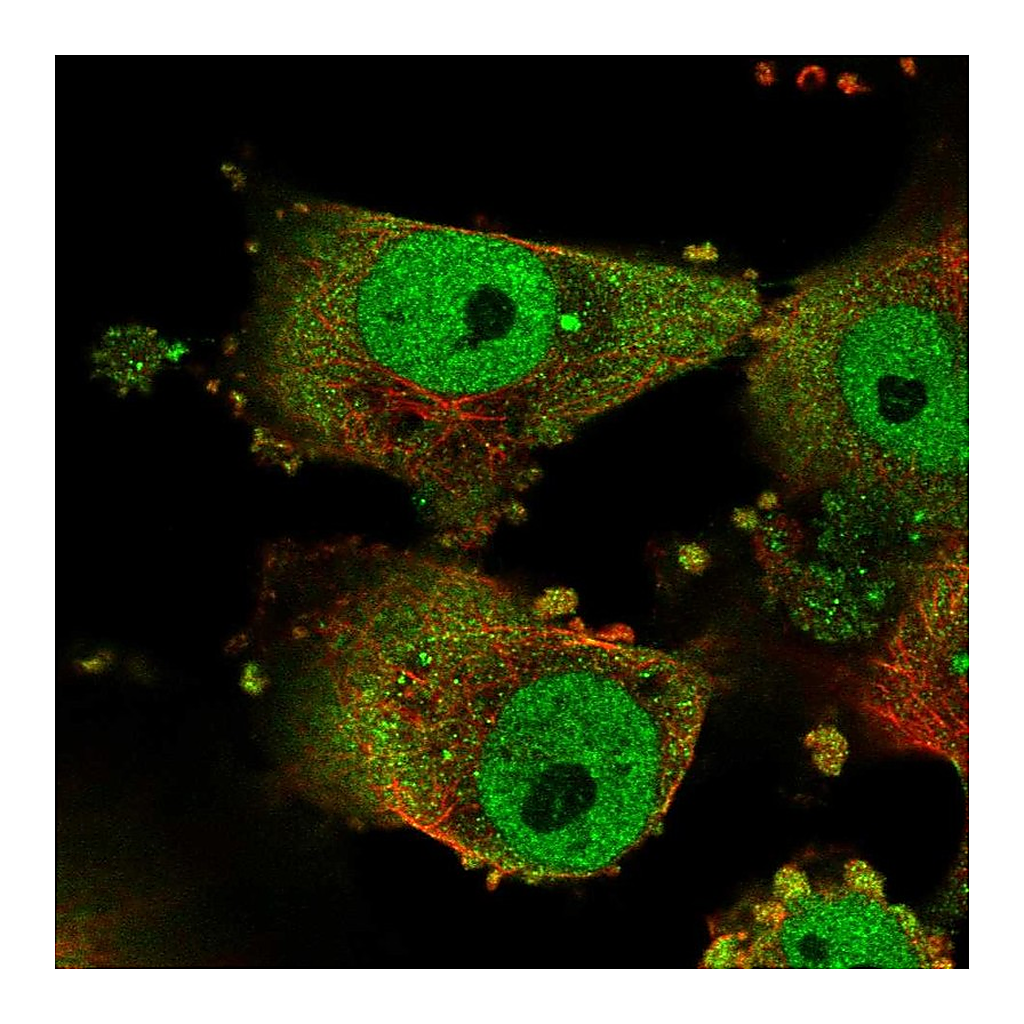 Atlas Antibodies Anti-GPATCH3 Antibody