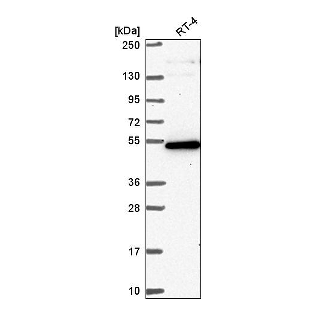 Atlas Antibodies Anti-GPATCH4 Antibody