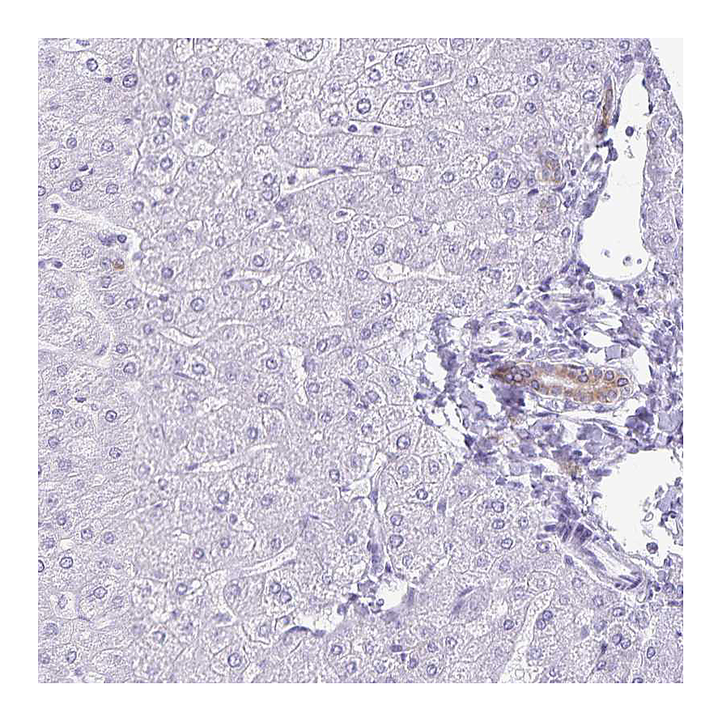 Atlas Antibodies Anti-GPBAR1 Antibody